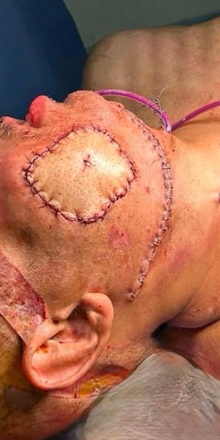 Surgical procedure