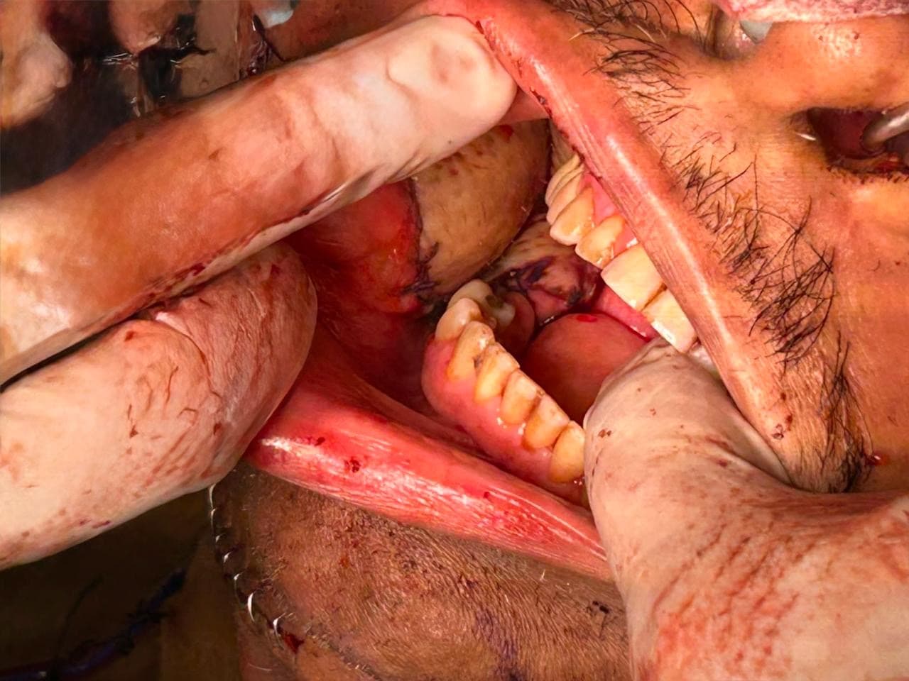 Pre-operative assessment