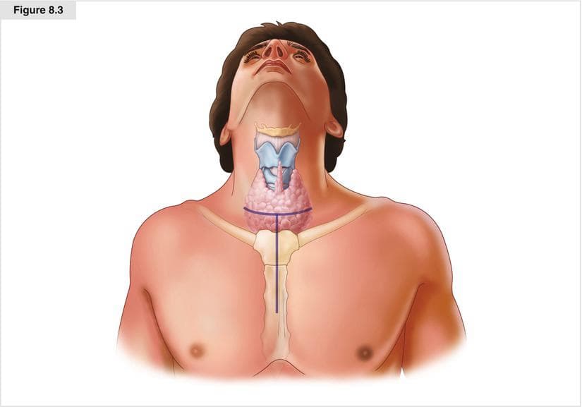 Surgical procedure
