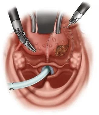 Pre-operative assessment